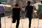 جوانان فلسطینی که پس از حمله هوایی رژیم اسرائیل یک پای خود را از دست داده‌اند
